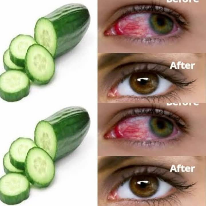 Refresh Your Vision: A Daily Cucumber Elixir for Enhanced Eyesight