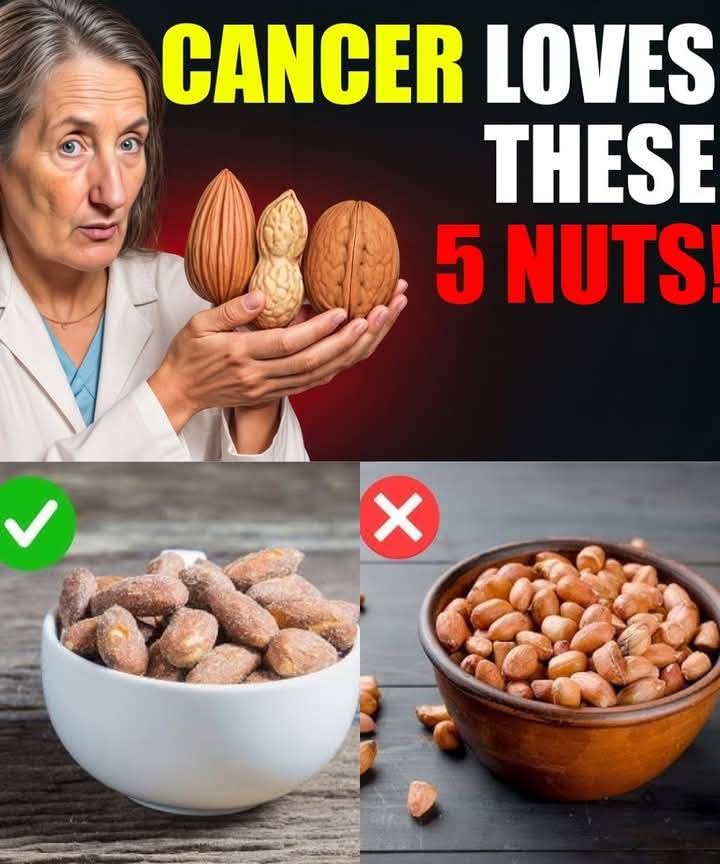 WARNING: Stop Eating These 5 Nuts Immediately! They Are KILLING You! | Barbara O’Neill