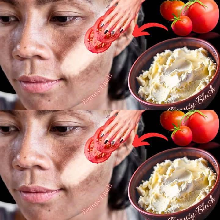 Look Fresh & Youthful with This Simple Tomato & Cornstarch MaskFeel Like 16 Again – Naturally!