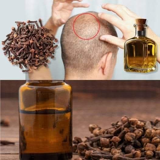 Hair growth treatment with clove oil