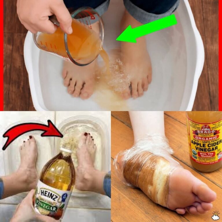 Revitalize Your Feet with a DIY Apple Cider Vinegar Detox Soak