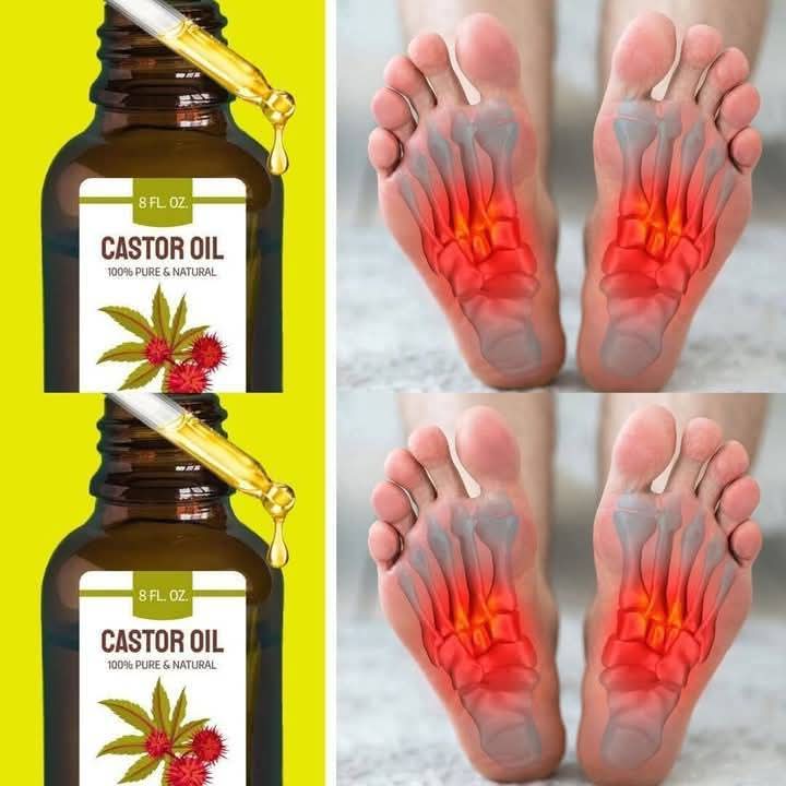 The Remarkable Effects of Castor Oil When Used Before Bed