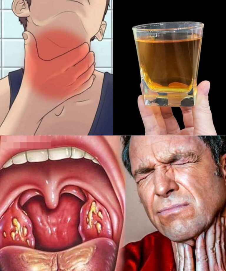 Kills Sore Throat and Inflammation – Cloves: Nature’s Antibiotic! 