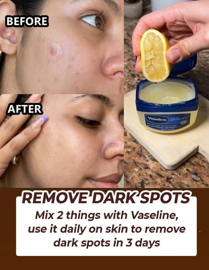 Vaseline: The Ultimate Skincare Essential