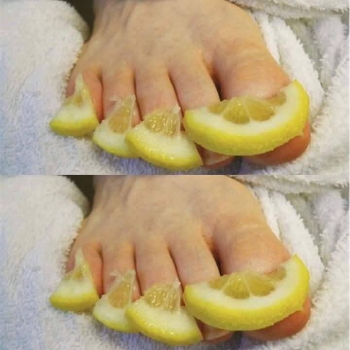 This Will DESTROY Toenail