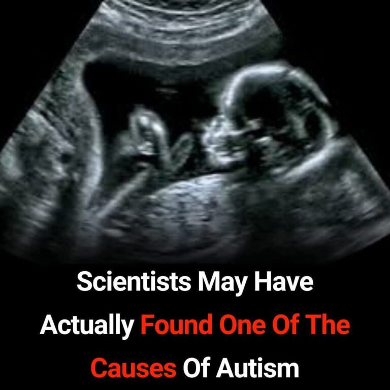 One Step Closer: Scientists Identify a Potential Prenatal Cause of Autism