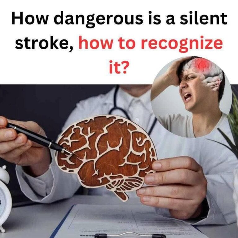 Silent Stroke: The Hidden Threat to Health