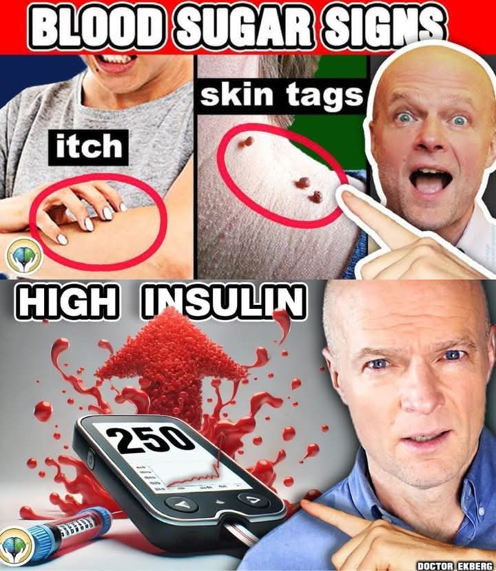 10 Signs of High Insulin