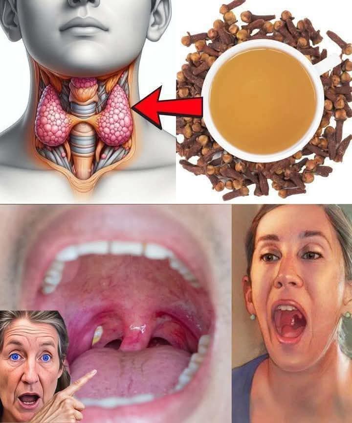 Cloves for Sore Throat Relief: A Natural Way to Soothe Inflammation and Support Healing