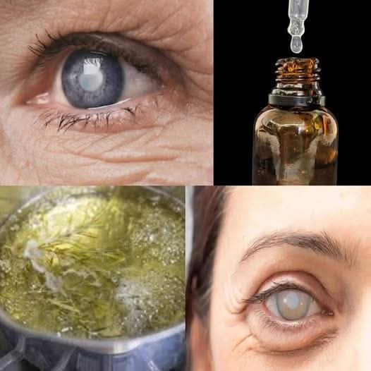 It KILLS Cataracts, Restores Vision & Relieves Eye Inflammation – The Natural Way 