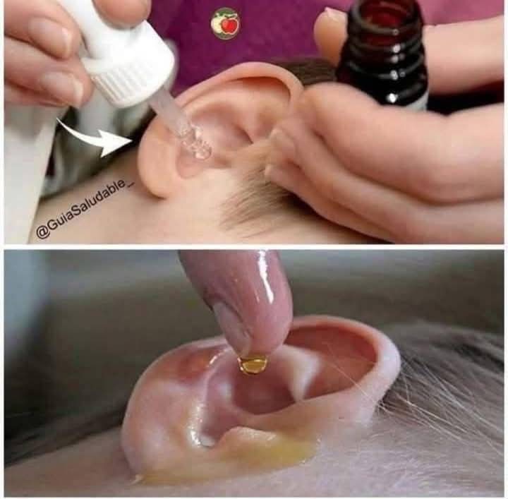 Put 2 drops in your ear and you will hear like before. Recover your hearing.