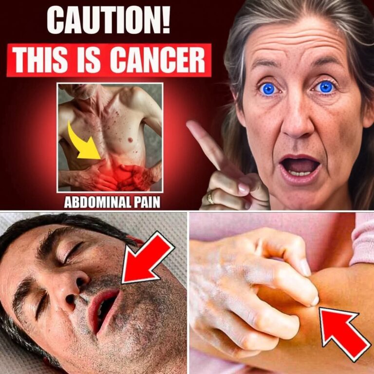ALERT! 10 Strange Symptoms of Pancreatic Cancer Few People Notice — #7 Will Shock You