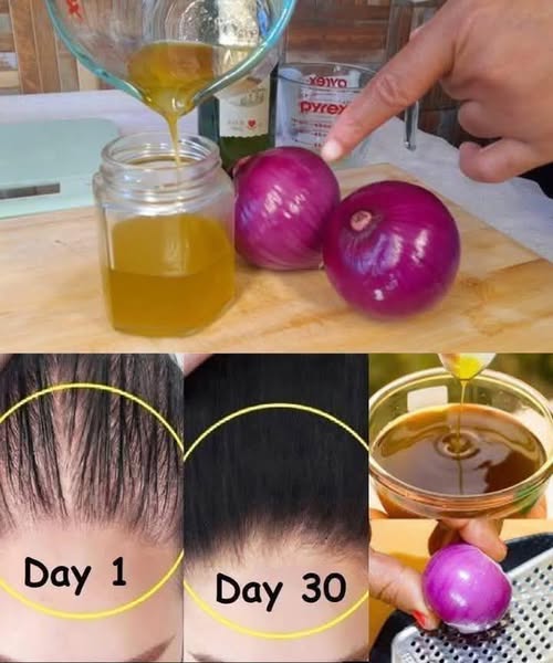 How to Make Onion Hair Oil for Faster Hair Growth and Stop Hair Fal
