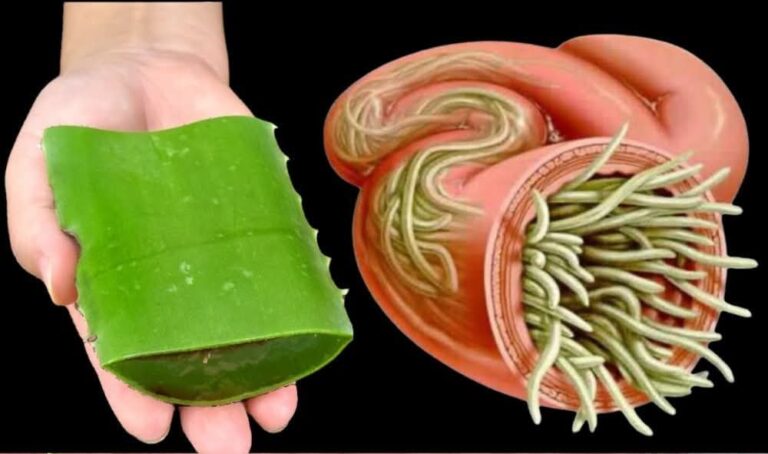 This Aloe Vera Recipe Is 150 Times Stronger Than Garlic, Lemon, and Antibiotics – Destroys Bacteria and Fungi Naturally!