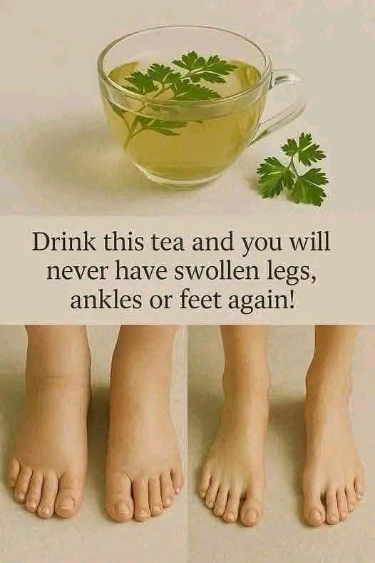 🍵 Anti-Swelling Detox Tea