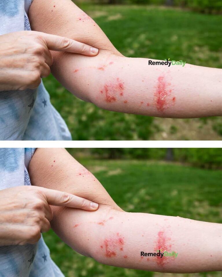 Came back from camping and got some red, itchy skin. Doctor isn’t available for another week. What should I do?