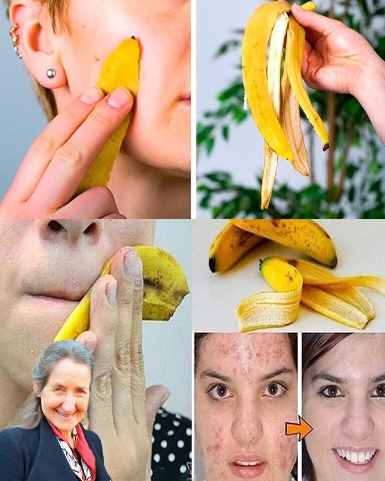 Banana Peel Anti-Aging Mask: A Natural Secret for Radiant Skin