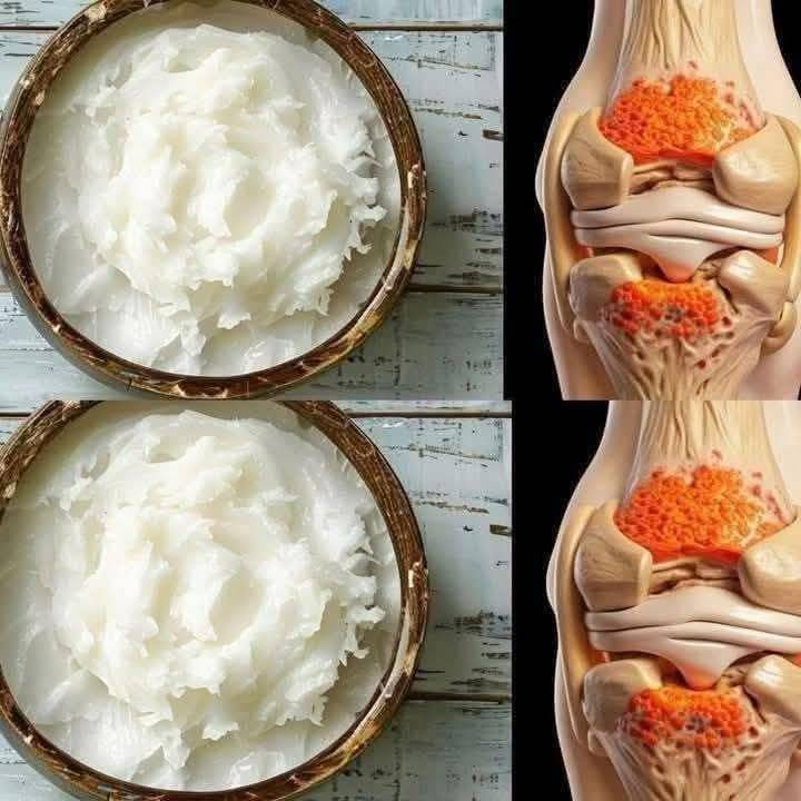 Foods to Rebuild Knee Cartilage: This Is What You Should Eat!
