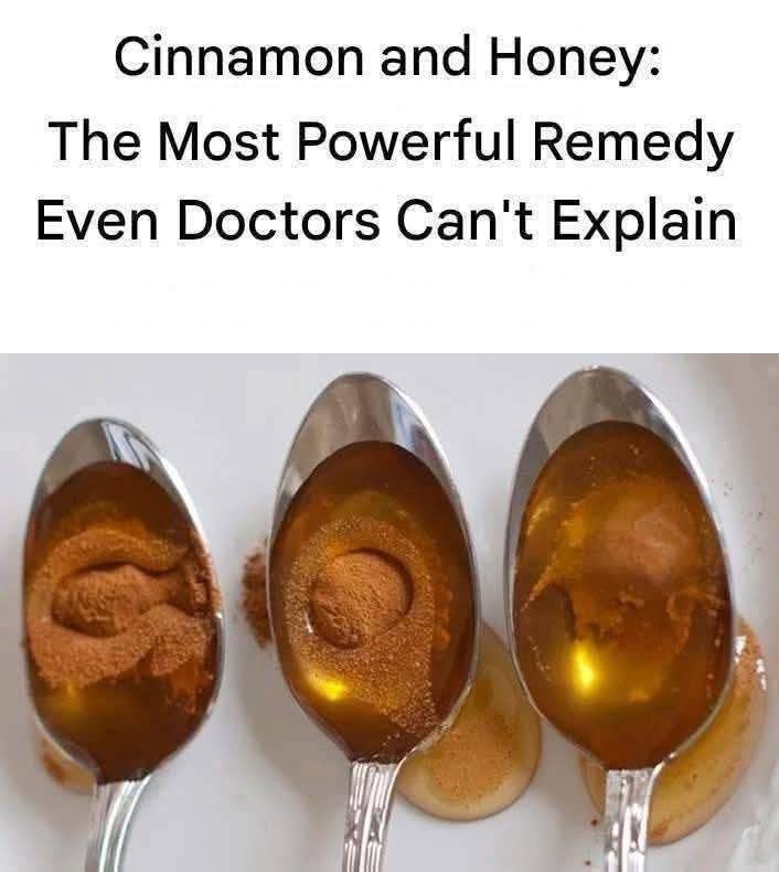 Cinnamon and Honey: A Powerful Remedy Even Doctors Can’t Fully Explain