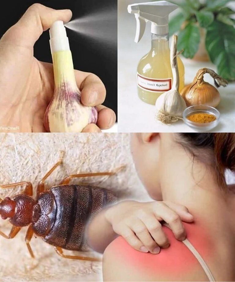 Bedbugs: Simple Methods to Eradicate Them from Your Home