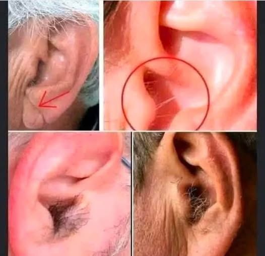 Why Do We Get More Ear Hair as We Age?