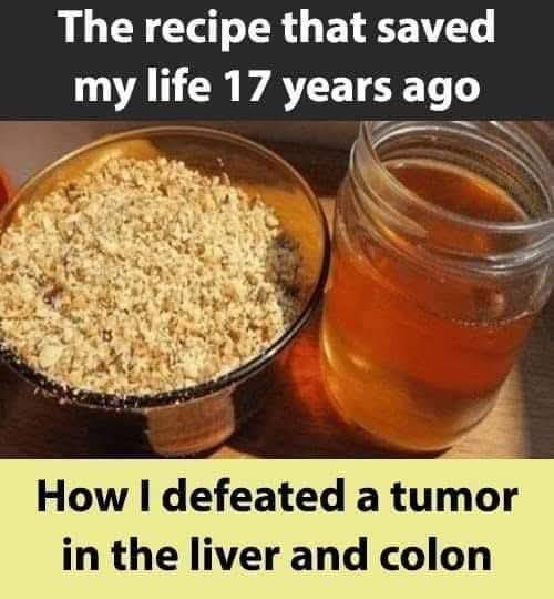 Overcame Liver and Colon Tumors 17 Years Ago With This recipe