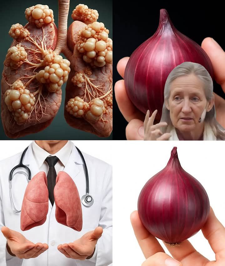 How Onions and Garlic Can Help You Get Relief From Chronic Coughs