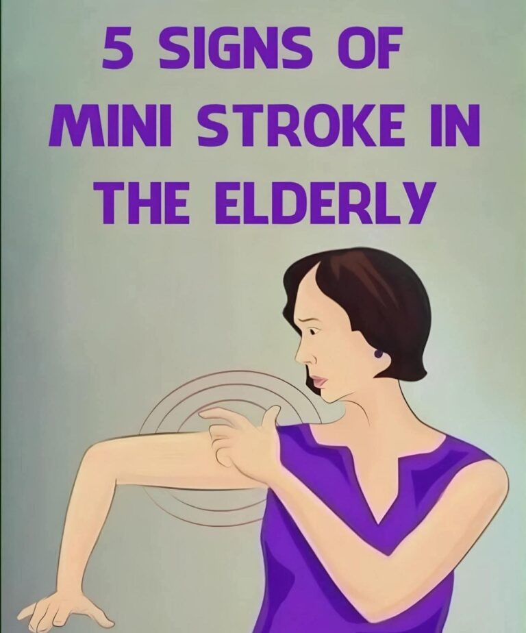 7 Warning Signs of a Mini Stroke in the Elderly