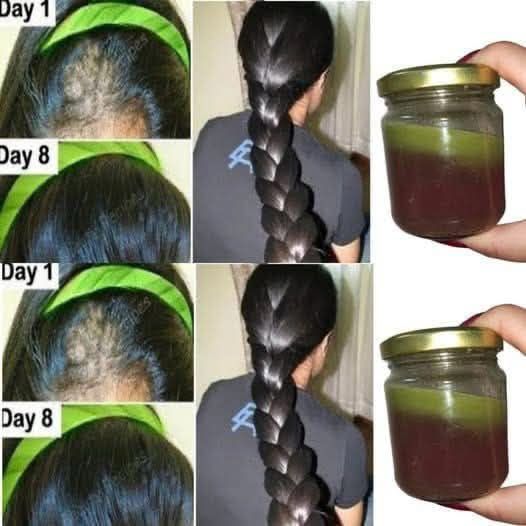 The Indian Secret: Using Cloves to Promote Rapid Hair Growth and Treat Baldness